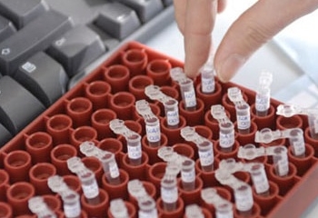 Doping: contrasto, prevenzione e promozione della salute”, seminario organizzato da Cersal e Usl al Csco