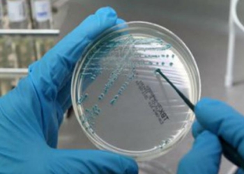 Legionella, due casi nell’Orvietano. In corso indagini epidemiologiche, esclusa contaminazione acquedotto comunale