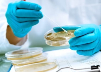 Contaminazione da Escherichia Coli, Giovannini: “Quali azioni si intraprenderanno per limitare il contagio?”