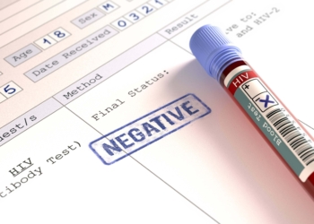 NEETagers, test gratuito dell’HIV in Piazza De Sica a Narni Scalo