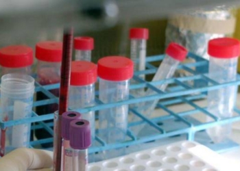 Coronavirus: rimane invariato il numero di positivi in Umbria (1431). Sesto giorno senza contagi. L’andamento di maggio