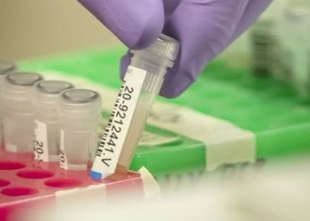 In Umbria studi su sequenziamento Sars-Cov2 solo a fini di verifica delle sue caratteristiche