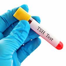 Avis Acquapendente offre gratuitamente l’esame del TSH alle sue donatrici