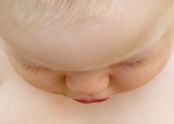 Diabete pediatrico: importanti semplificazioni per le famiglie